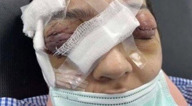 كشفت تفاصيل مثيرة..  والدة معنفة جدة السعودية : لو تنازلت ابنتي سأقتل نفسي