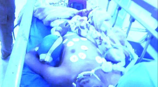 مسلحون بصنعاء يطلقون النار على مهمش حاول دفن فتاة 