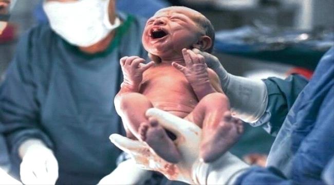 طفلة تولد بحالة نادرة بعد العثور على توأمها داخل معدتها