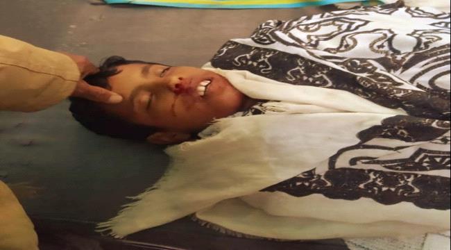 حصري.. مصدر أمني يكشف (لـعدن حرة) تفاصيل استهداف قائد عسكري في طور الباحة