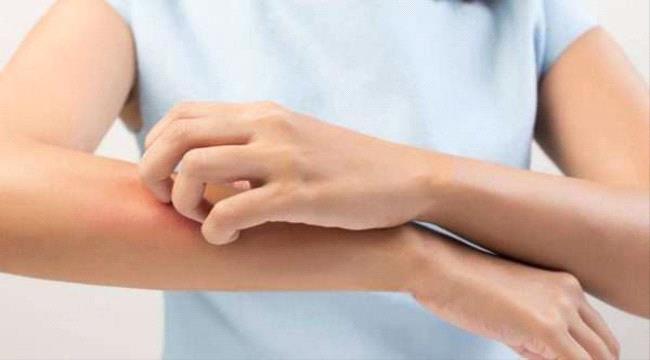 3 علامات على الجلد تدل على الإصابة بأوميكرون