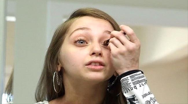 عشرينية تبدو وكأنها بعمر طفلة في الثامنة بسبب حالة نادرة