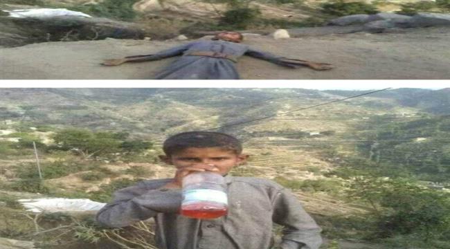 في واقعة نادرة و صادمة.. طفل يمني يمشي على بنزين  ! 