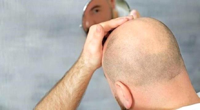 شركة إسبانية تنجح في شحن بطارية من رأس الرجل الأصلع