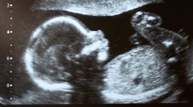 حفظ الحيوانات المنوية لا يؤثر على التلقيح الاصطناعي