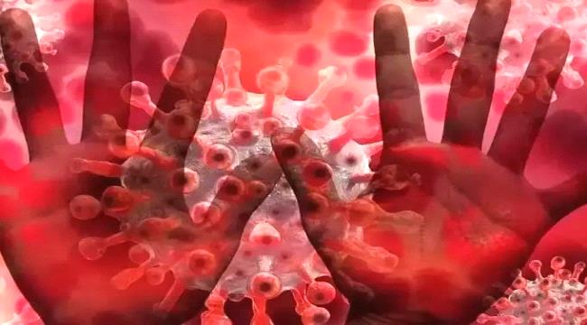 هل يمكن الإصابة بفيروس كورونا وجدري القرود في آن واحد؟.. خبير يُوضّح