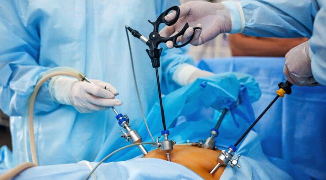 وفاة شاب كويتي بعد إجرائه عملية تكميم للمعدة "قص" 