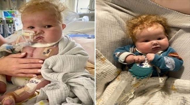 أول عملية زرع قلب لطفل بلا أدوية مثبطة للمناعة