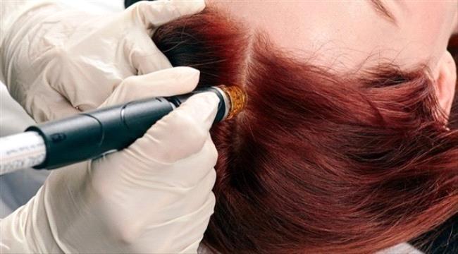 مستحضرات تقشير فروة الرأس تعالج جفاف الشعر