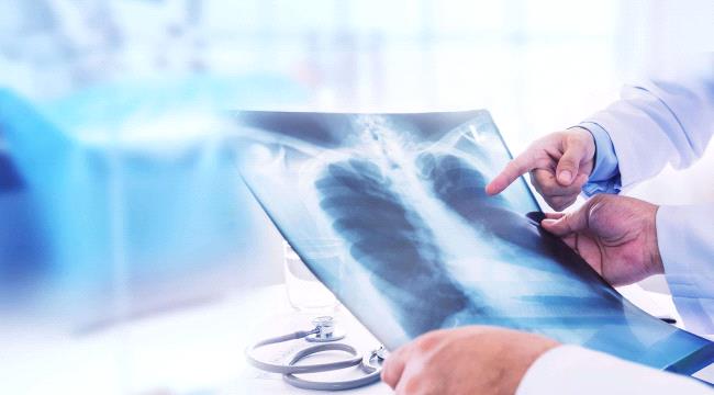 لماذا يصاب غير المدخنين بسرطان الرئة ؟