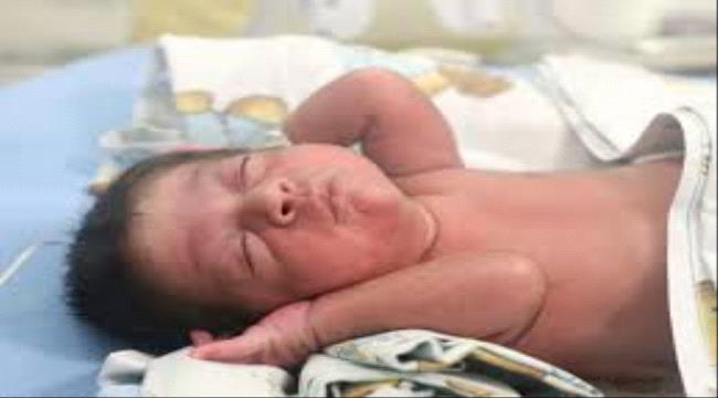 ولادة أول طفلين بمساعدة «روبوت»