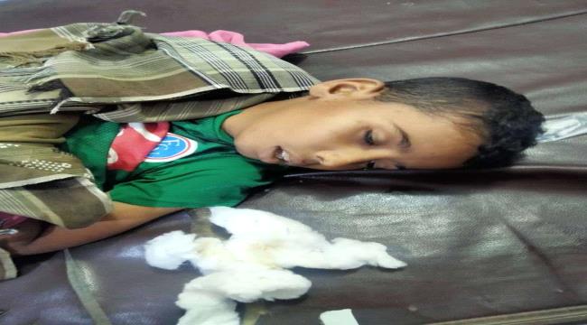 لحج.. قصة الطفل "منصور" مات قبل أن يجيب على أسئلة الامتحانات 