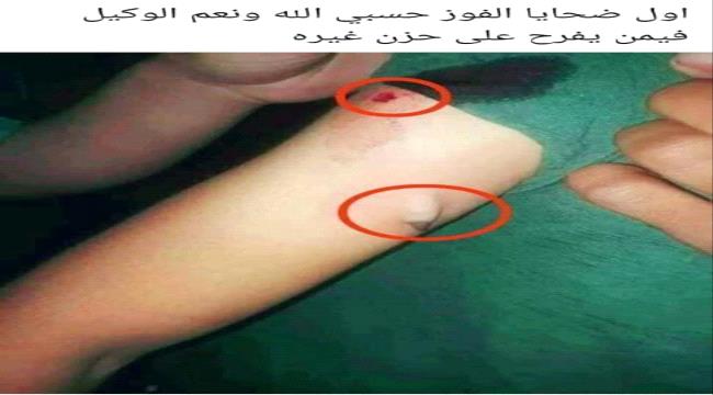 ضحايا فوز المنتخب اليمني في عدن (أسماء )
