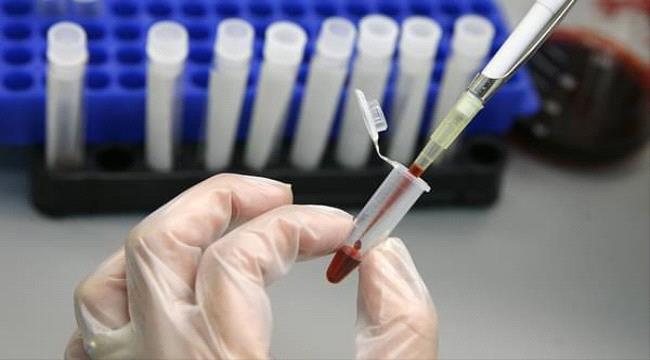 لقاح مطور يمنع فيروس الإيدز من دخول الجسم