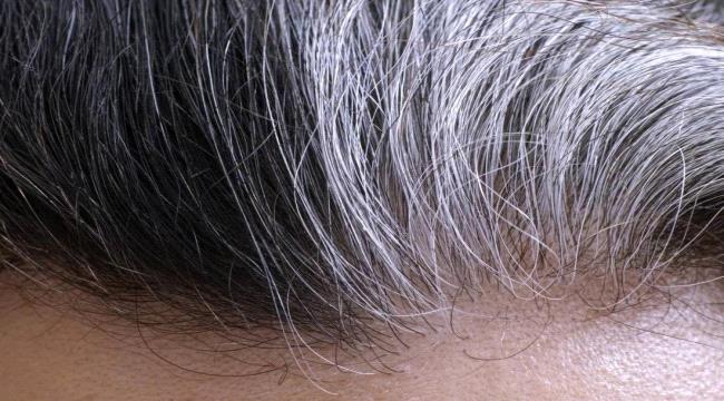 كيف تتجنب ظهور الشيب في مرحلة الشباب؟