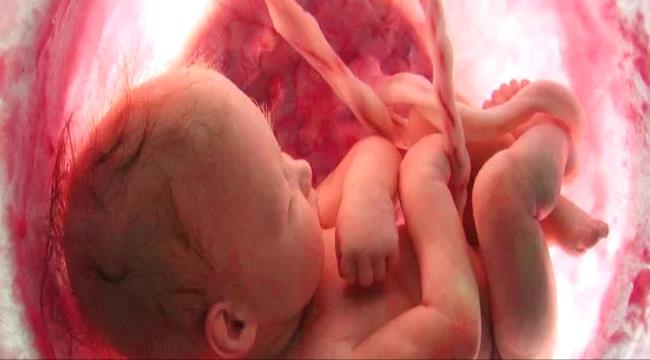 نجاح عملية "نادرة" لدماغ جنين في بطن أمه