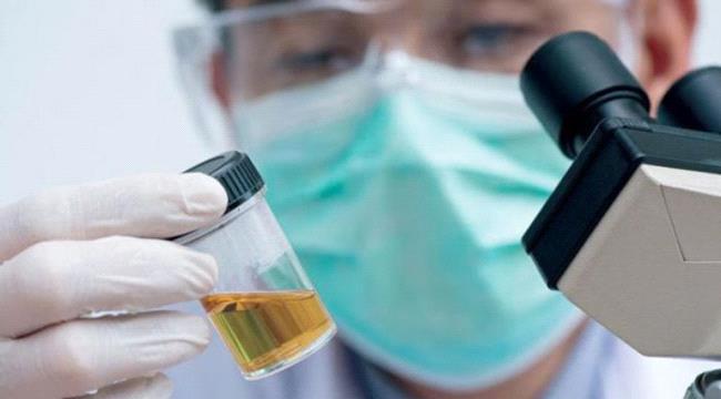 تغيرات في البول تدق ناقوس خطر الإنسان
