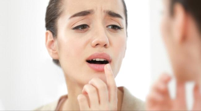 علاج حبة السخونة في اللسان ونصائح مهمة