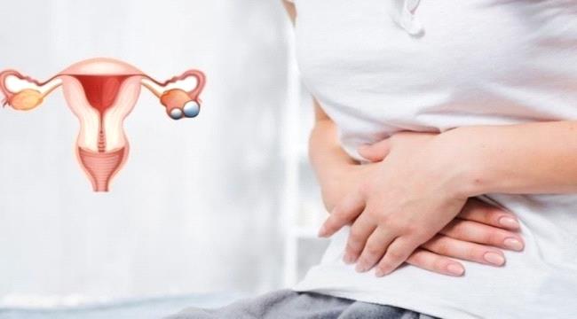 5 أطعمة تخفف من تكيس المبايض