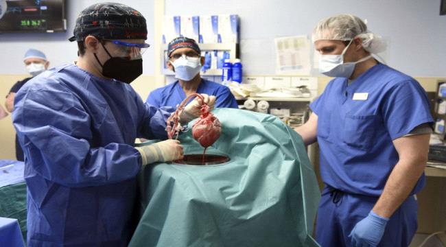 تقنية جديدة لزيادة عدد القلوب التي يمكن زراعتها