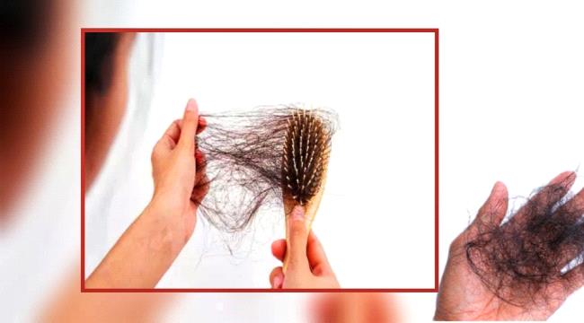 احذروا هذه الاطعمة...تسبب تساقط الشعر  