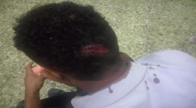 عصابة تقطع تعتدي على سائق سيارة في محافظة لحج 