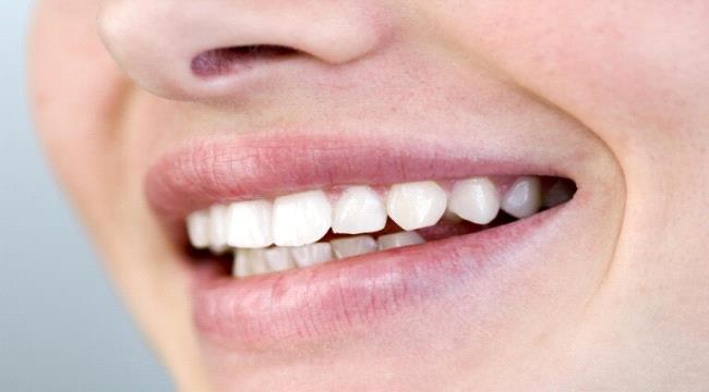 أسباب «ألم الأسنان» في الطقس البارد
