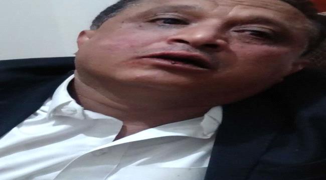 صحفي يمني : تعرضت للإعتداء ولم يتم ضبط الجناة حتى الآن 