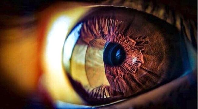 علامات في العين تشير إلى الإصابة بأمراض منقولة "جنسيا"
