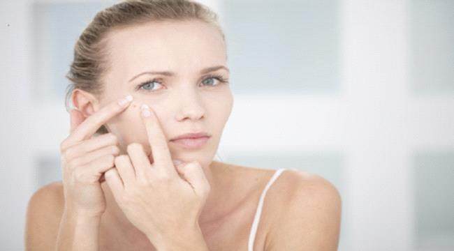 حب الشباب.. أطعمة وعادات تحفز ظهورها على الوجه