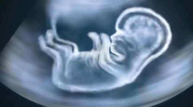 الموجات فوق الصوتية وسيلة جديدة للتنبؤ بالولادة المبكرة
