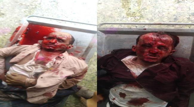 حوادث الطرق بلحج.. أرواح تحصد ودماء تهدر