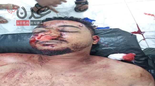 صورة صادمة من لحج لشاب لقي حتفه على يد زوجته