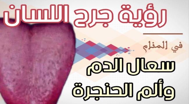 رؤية جرح اللسان في المنام.. تفسير حلم سعال الدم وألم الحنجرة والحلق