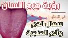 رؤية جرح اللسان في المنام.. تفسير حلم سعال الدم وألم الحنجرة والحلق ...